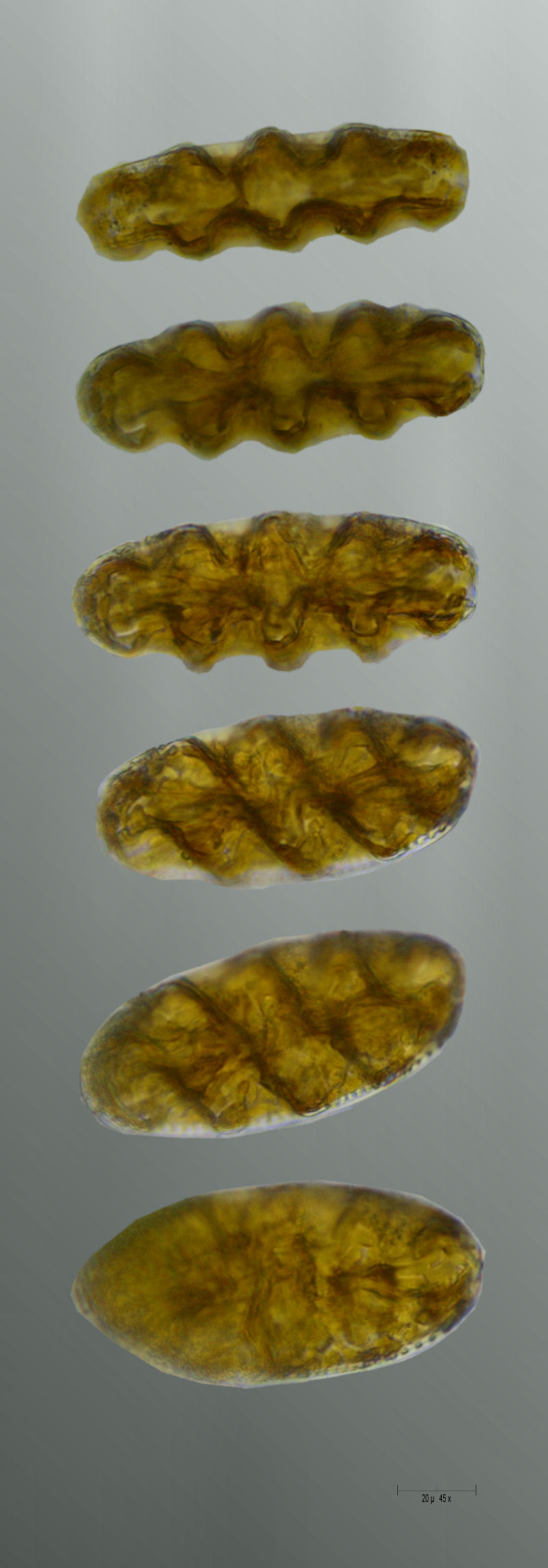 tuttattorno ad una Cymatopleura elliptica