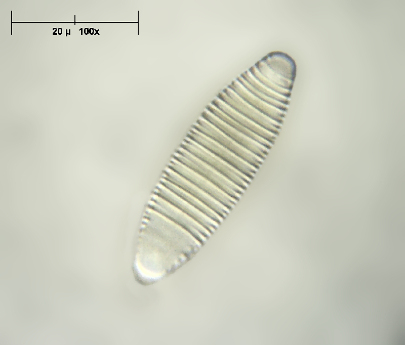 Diatoma vulgaris - vista valvare