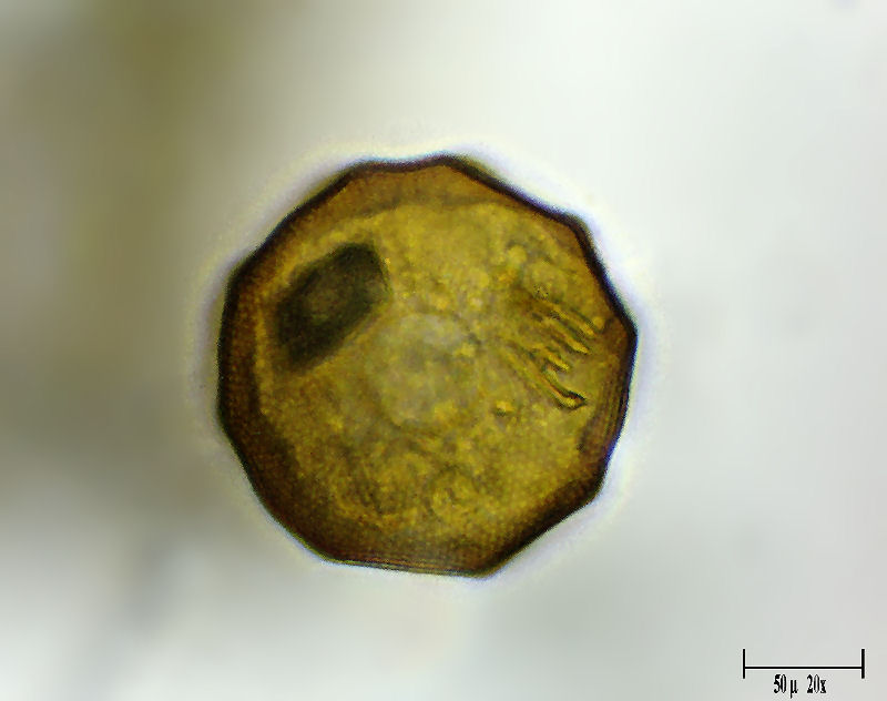 Arcella gibbosa