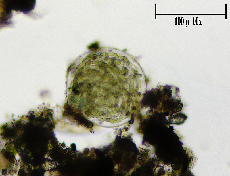 Sfera di cianobatteri  -  Nostoc sp.