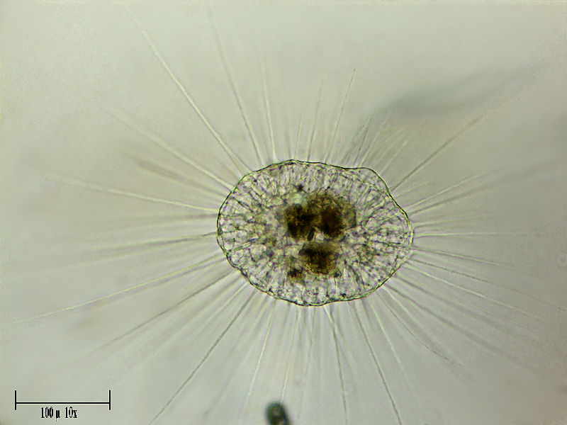 Helizoo enorme da identificare  [ Actinosphaerium sp. ]