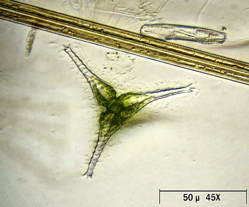 Staurastrum gracile