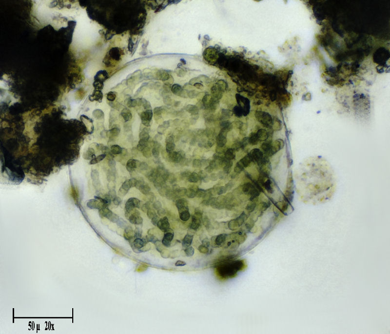 Sfera di cianobatteri  -  Nostoc sp.