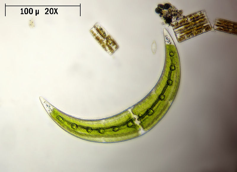 Closterium leibleinii