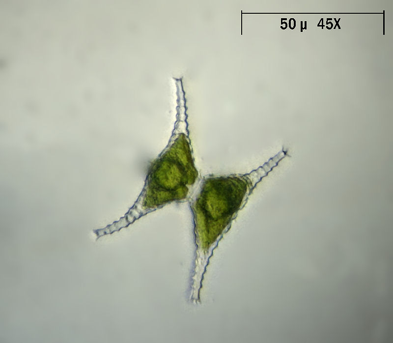 Staurastrum gracile