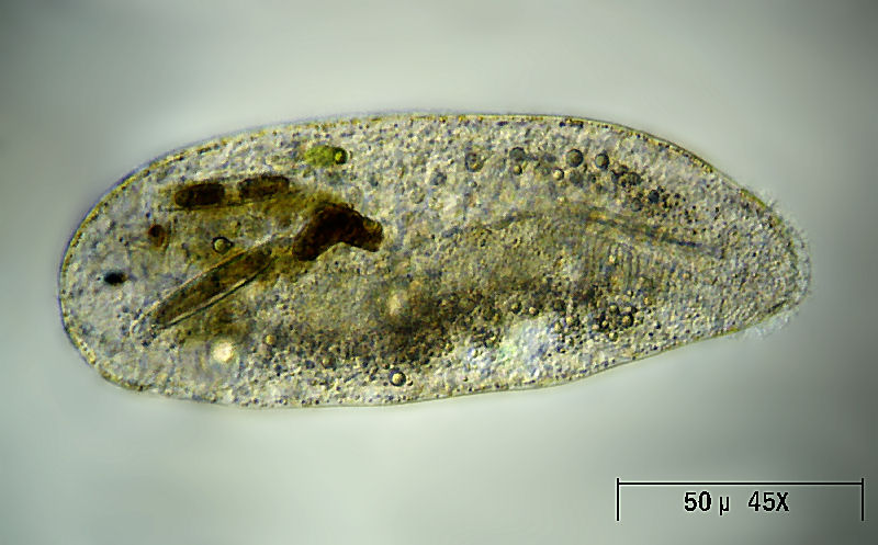 altro ciliato da identificare