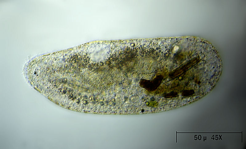 altro ciliato da identificare