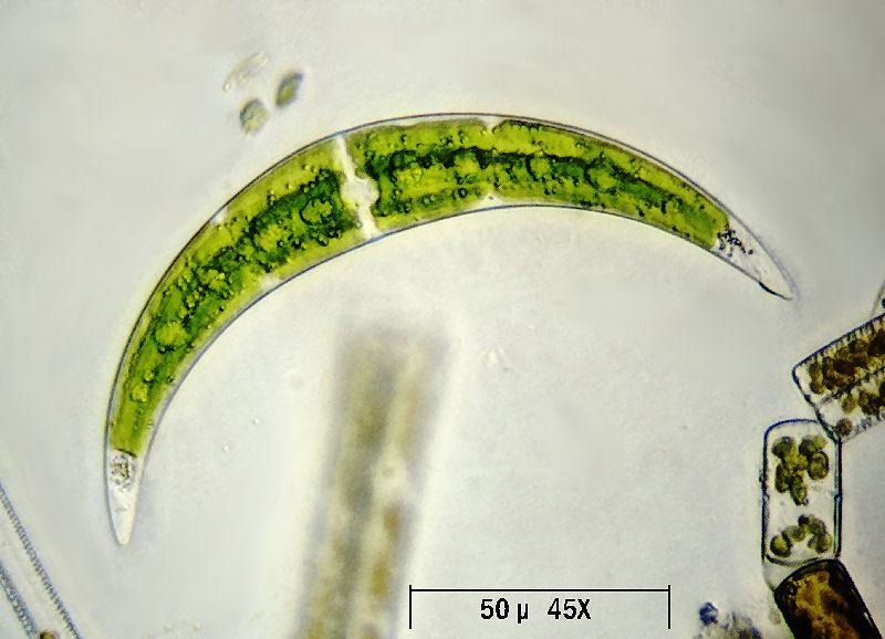 altri Closterium leibleinii