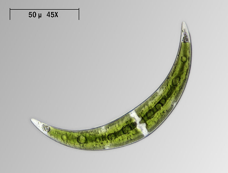 altri Closterium leibleinii