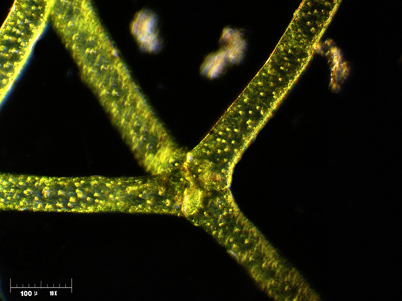 Hydrodictyon reticulatum 2