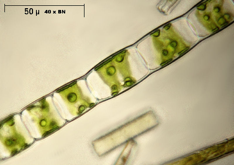 Ulothrix sp.