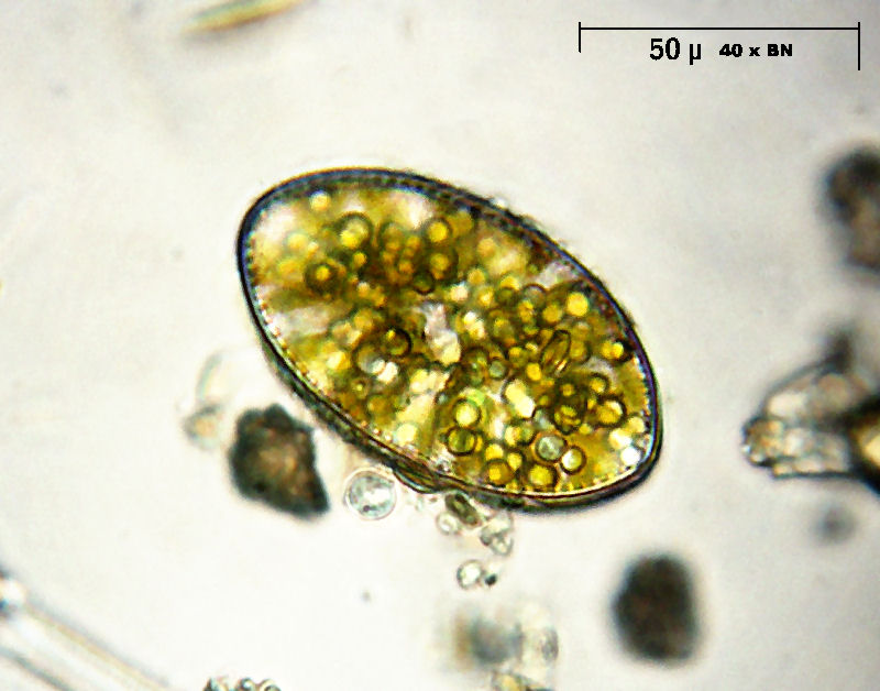 Cymatopleura elliptica