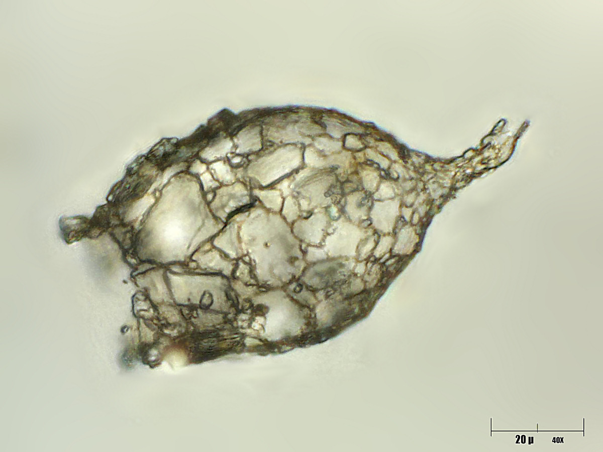 Difflugia acuminata