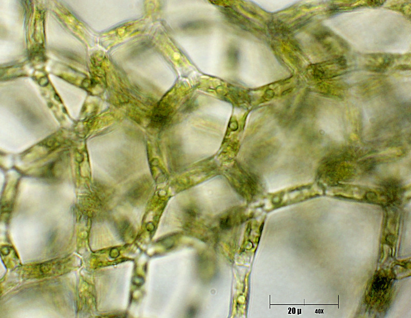 baby   Hydrodictyon reticulatum