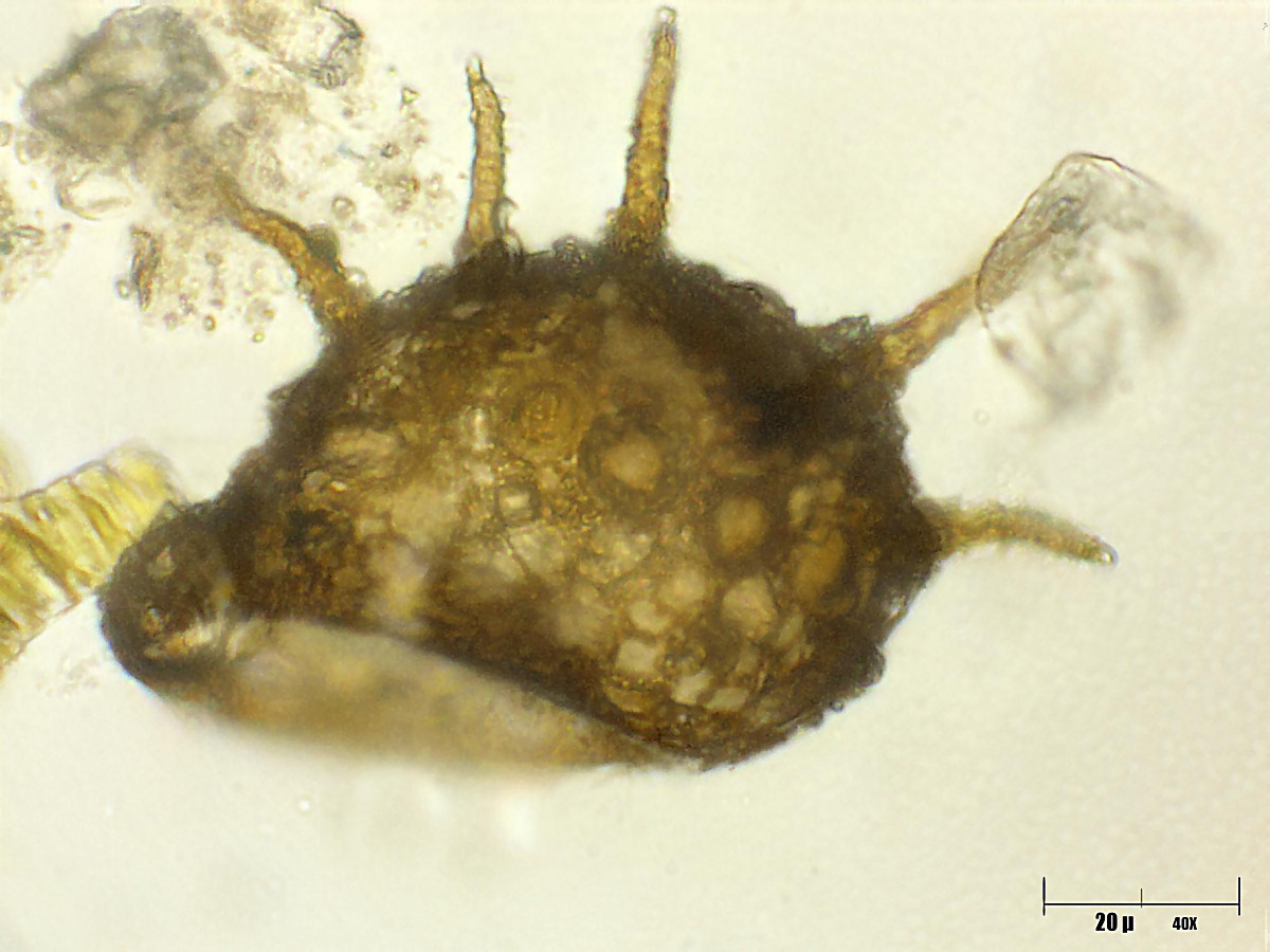 Centropyxis aculeata