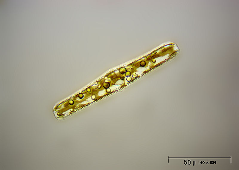 Rhopalodia gibba