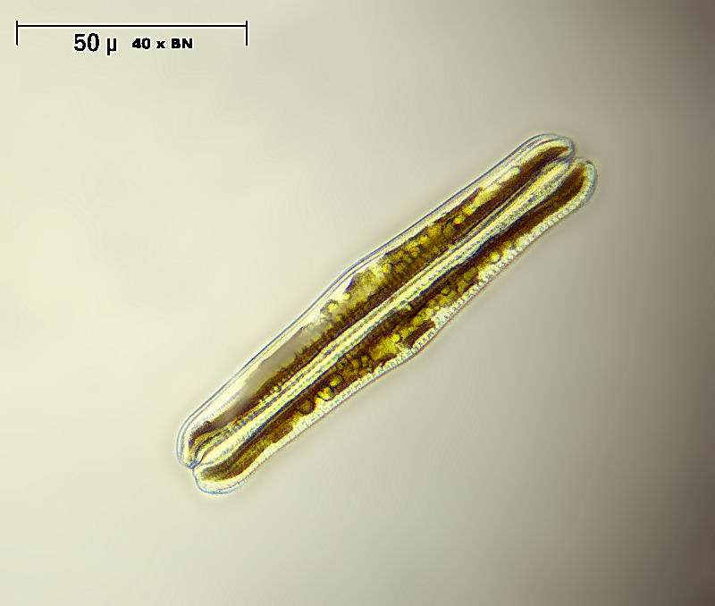 Rhopalodia gibba