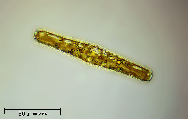 Rhopalodia gibba