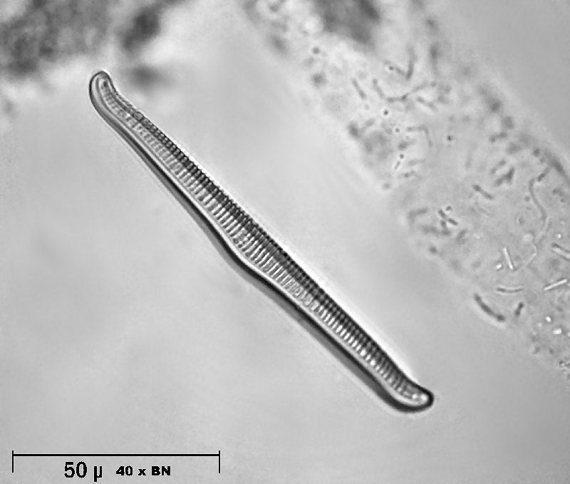 Rhopalodia gibba