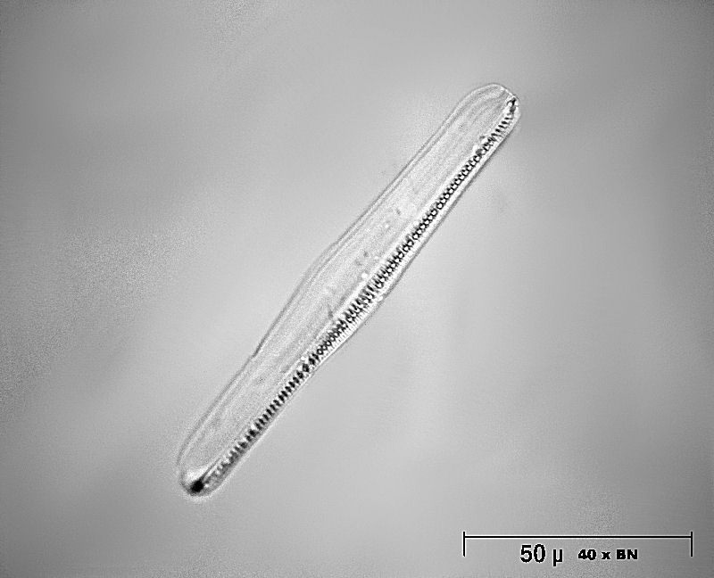 Rhopalodia gibba