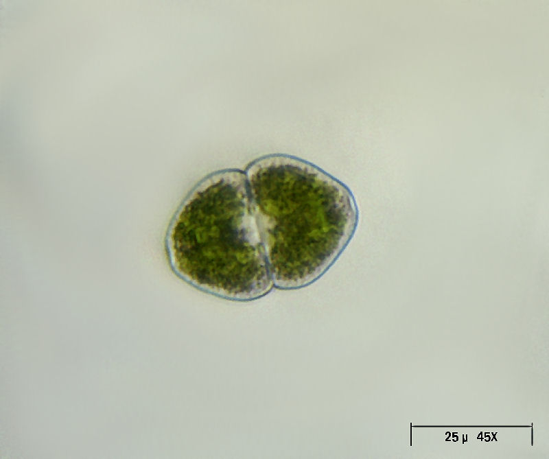 Cosmarium granatum