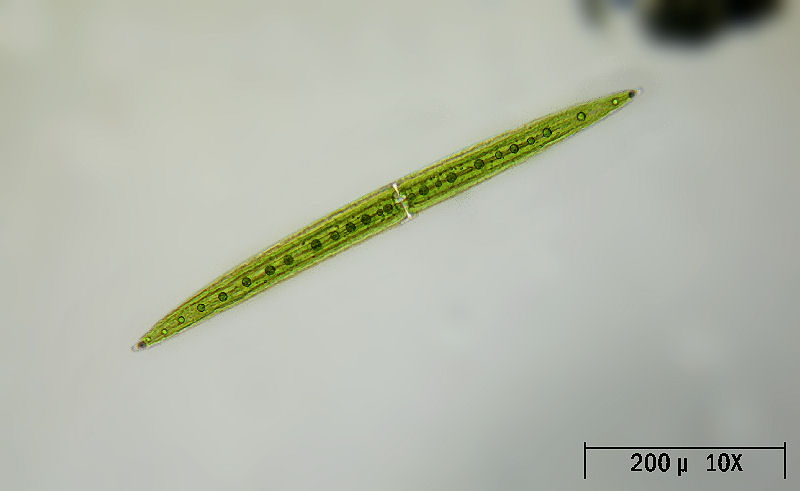 Closterium acerosum