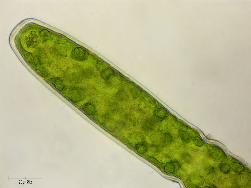 Pleurotaenium sp.
