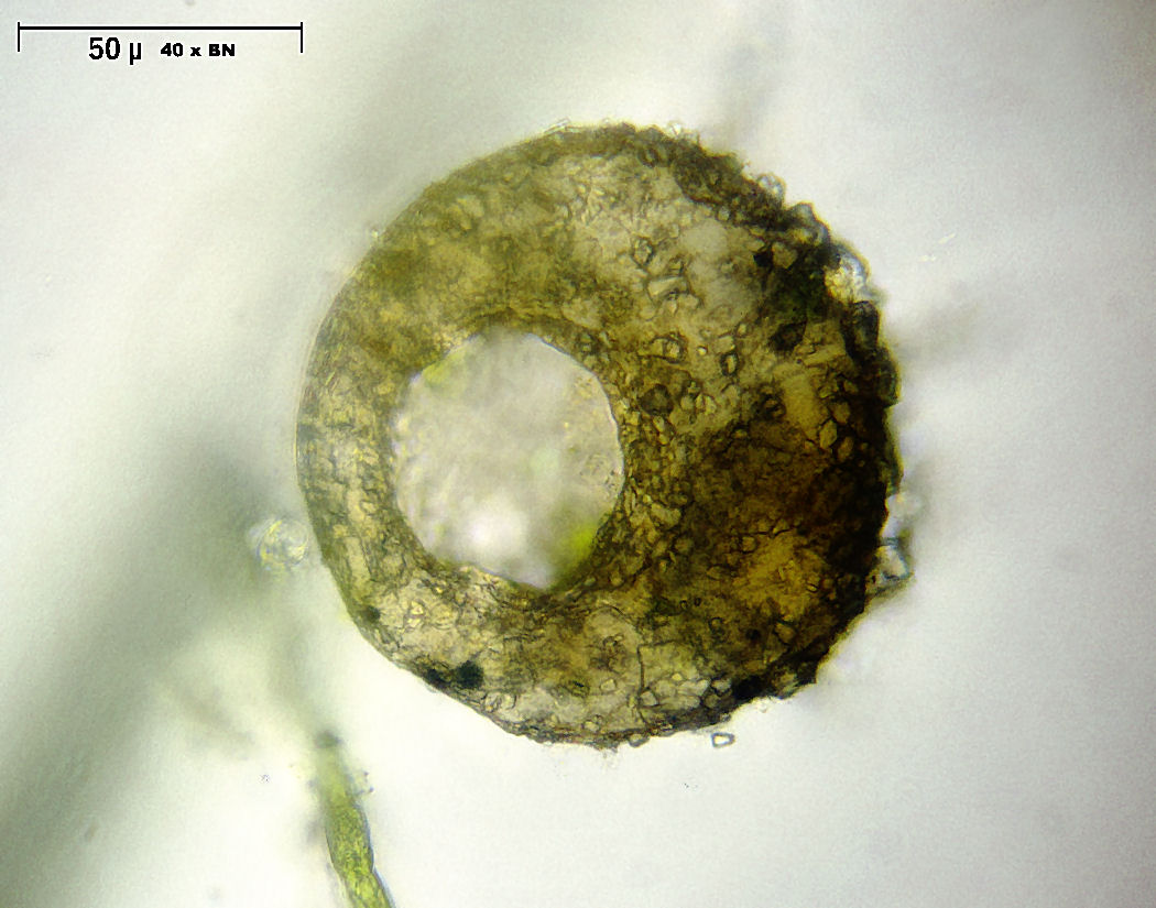 Difflugia globulosa