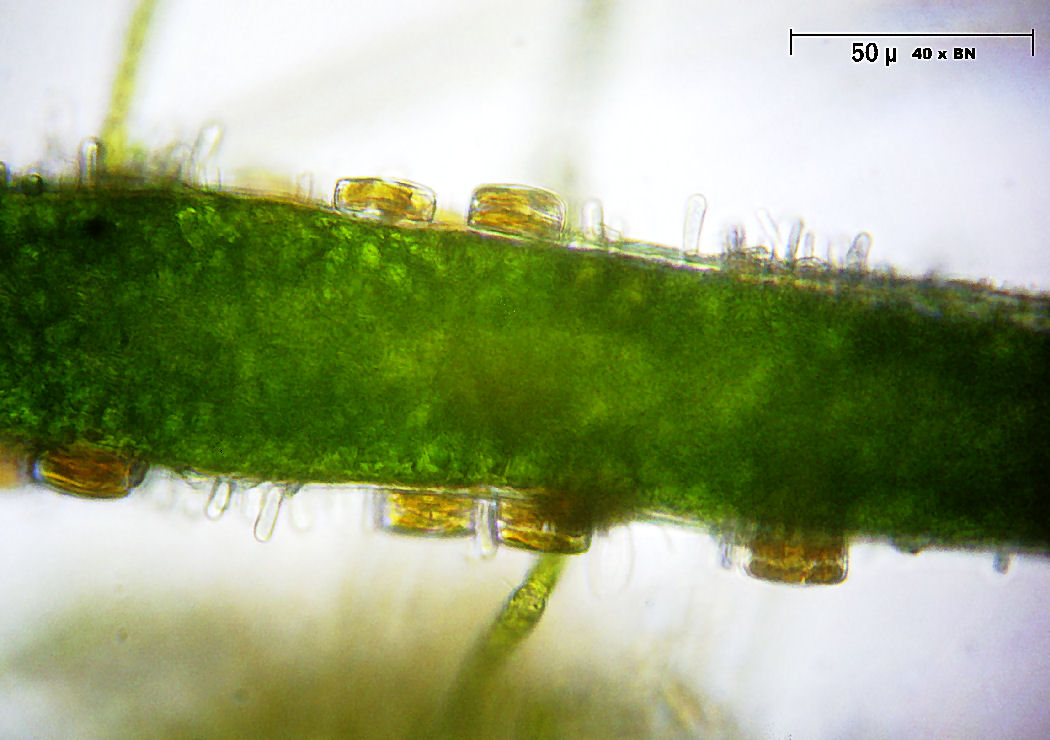 Epifite su Oedogonium [ Chamaesiphon sp. ]