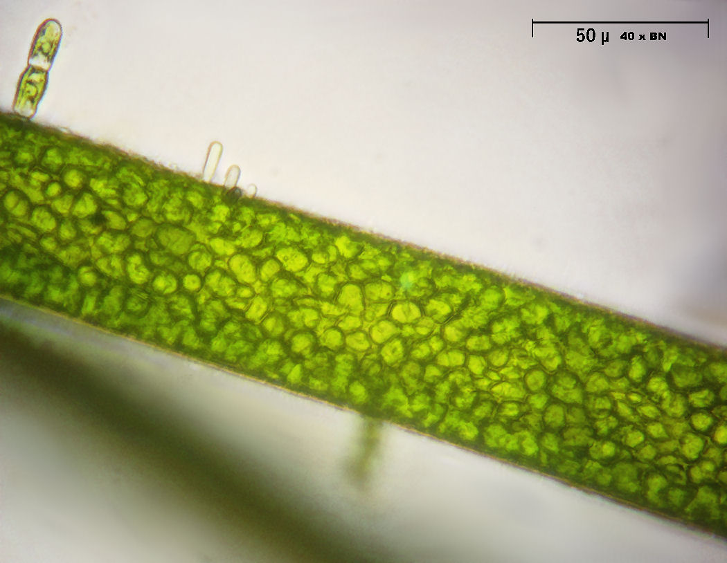cloroplasti di Oedogonium