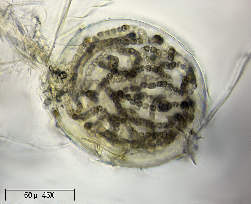 Sfera di cianobatteri  -  Nostoc sp.