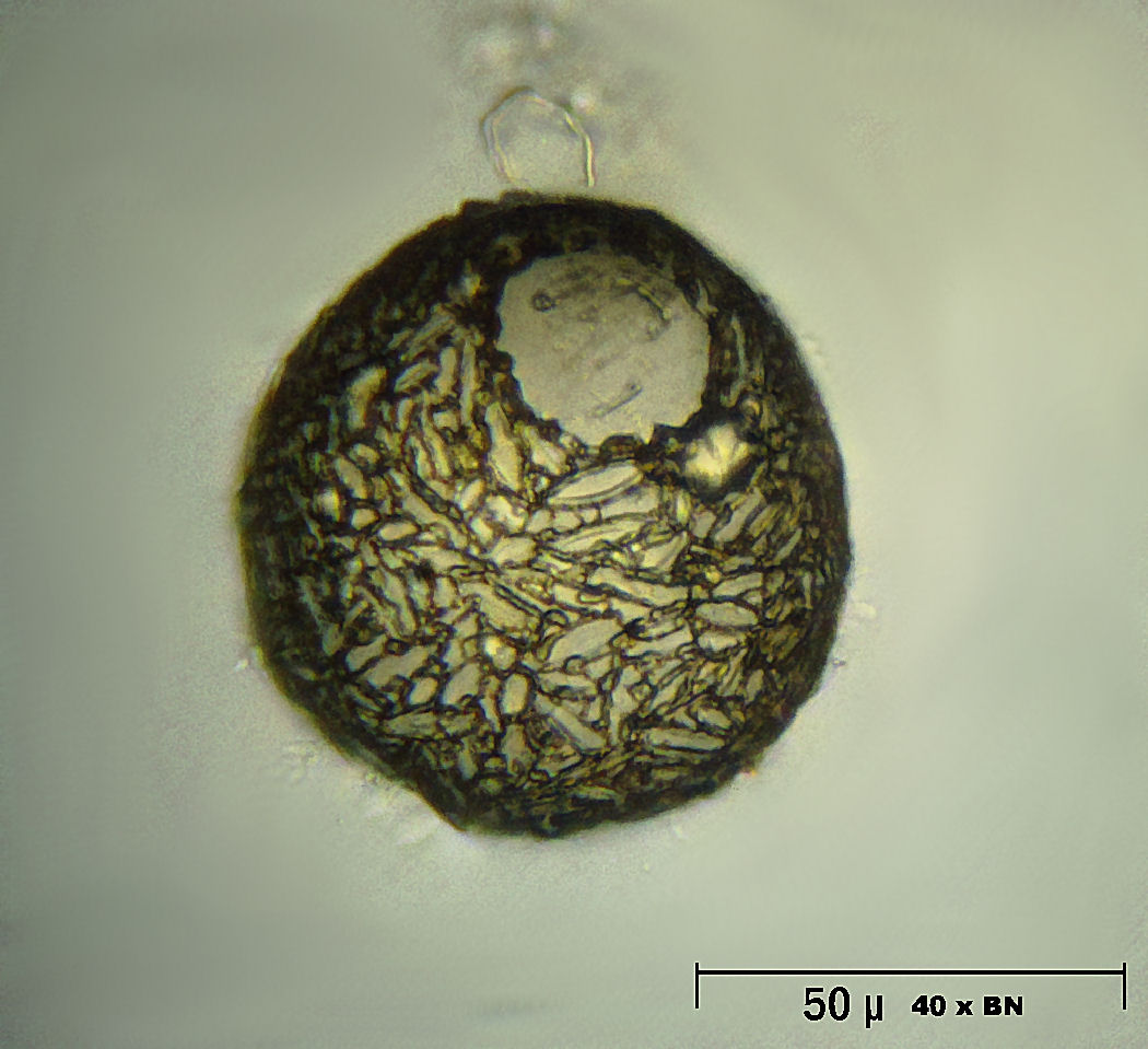 un''altra Difflugia globulosa