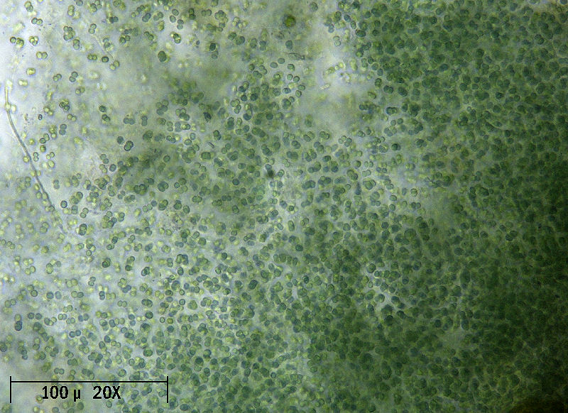 Microcystis sp.   forse M. flos-aquae