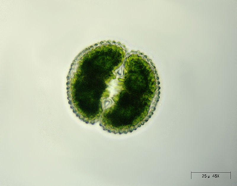 Cosmarium margaritatum