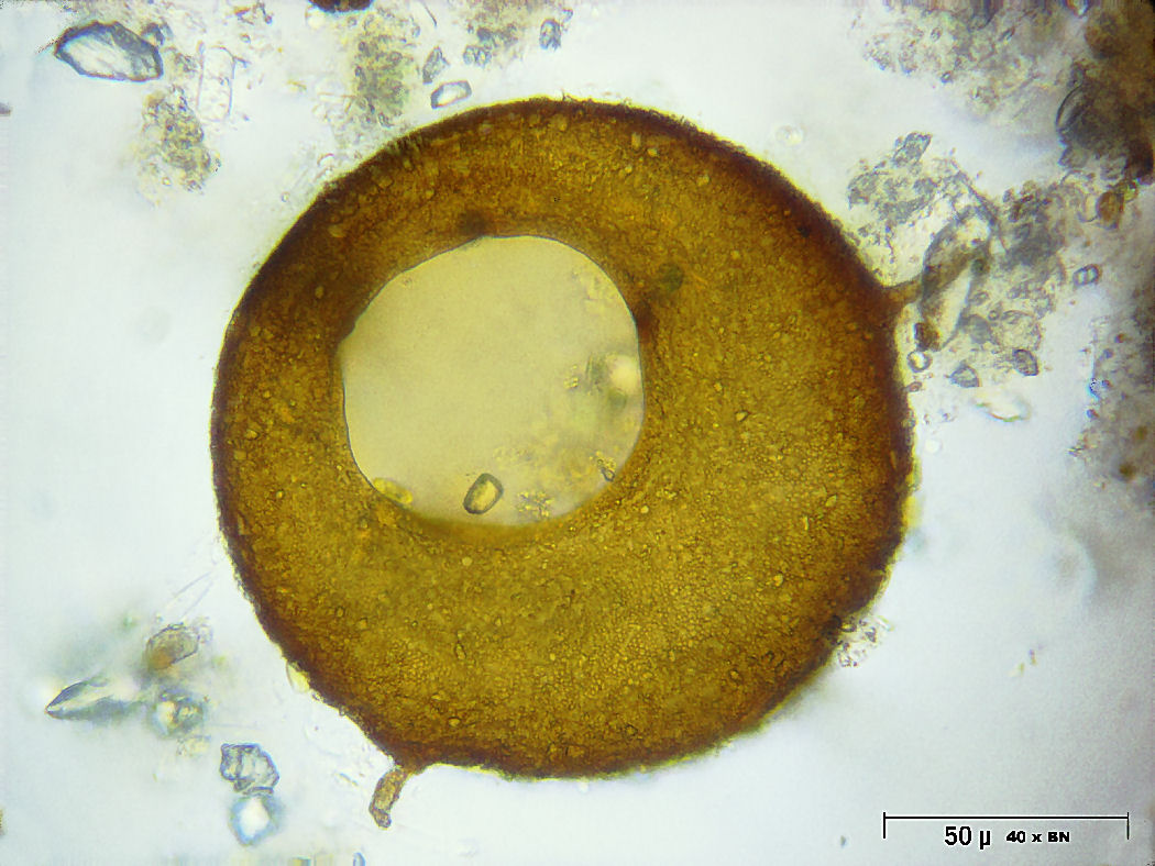 Centropyxis aculeata