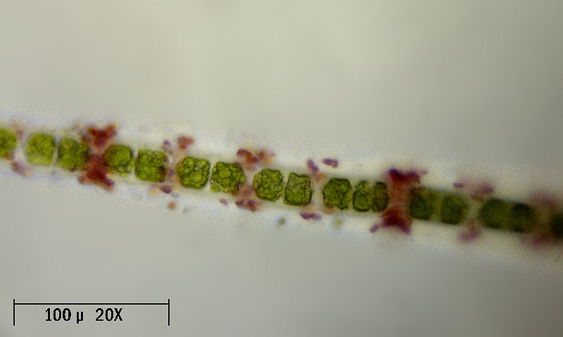 Hyalotheca sp.