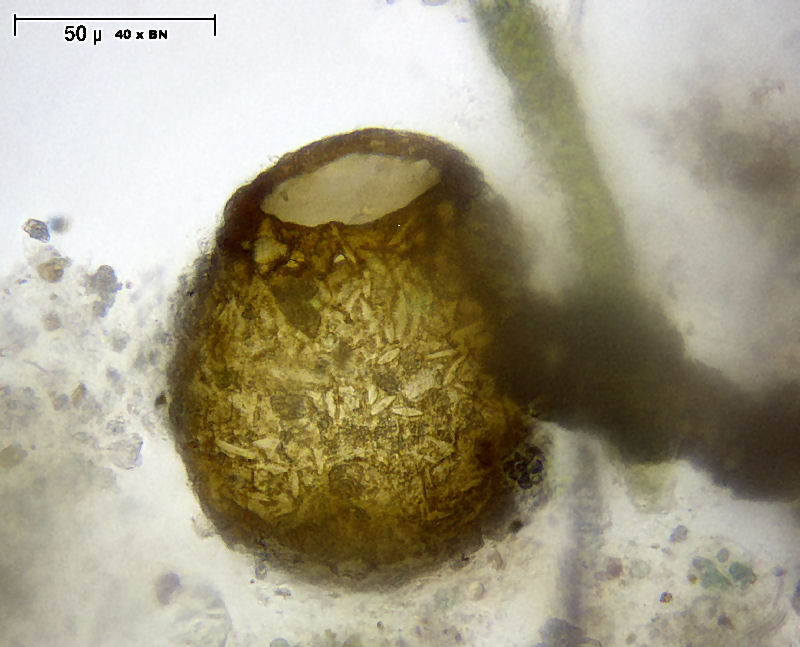Difflugia globulosa