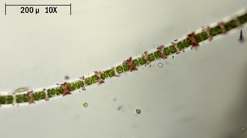 Hyalotheca sp.