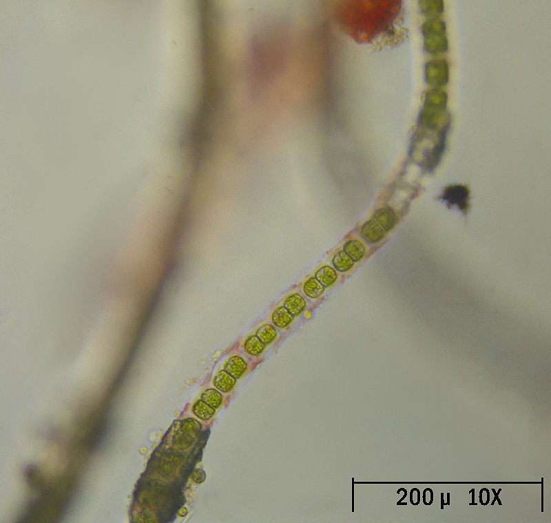 Hyalotheca sp.