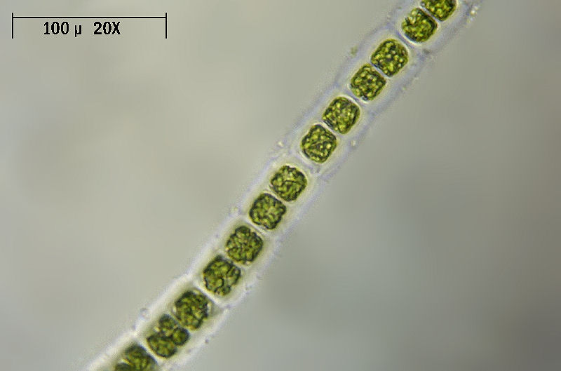 Hyalotheca sp.