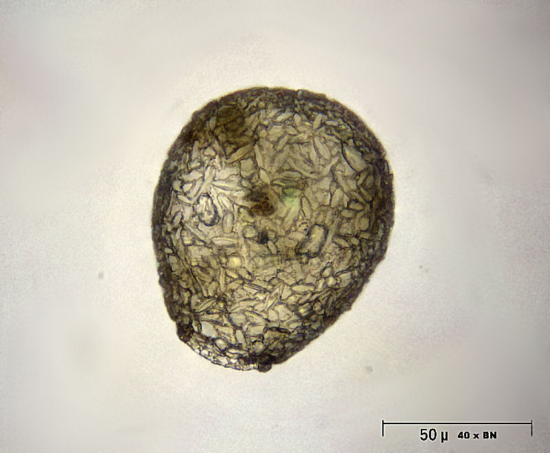 Difflugia globulosa