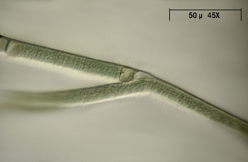 Tolypothrix sp.  - un cianobatterio ramificato