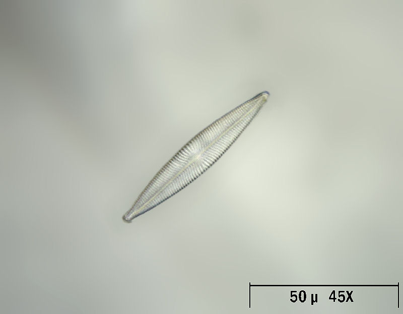 Navicula radiosa