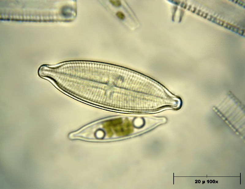 Placoneis elginensis