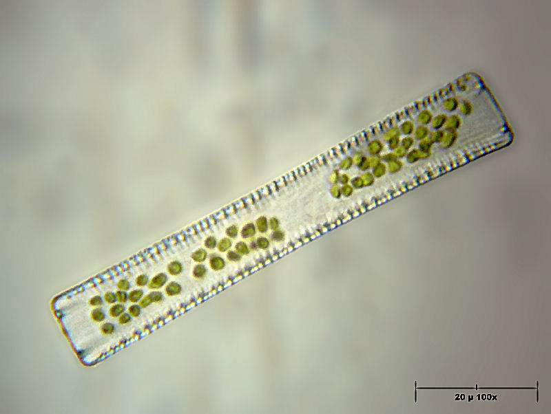 Diatoma tenue  -  vista connettivale