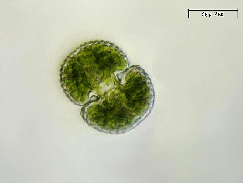 Cosmarium margaritatum