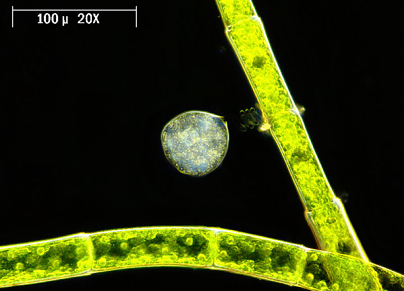 vorticelle campo oscuro