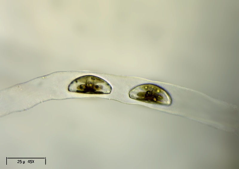 Encyonema caespitosum
