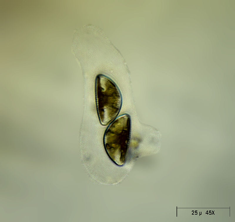 Encyonema caespitosum