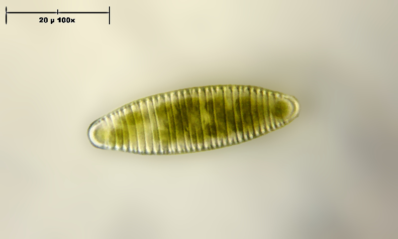 Diatoma vulgaris - vista valvare
